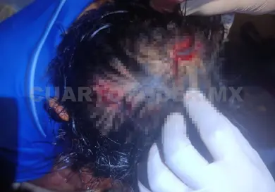 Apedrean a hombre en Jardines del Norte