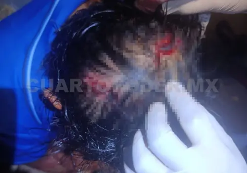 Apedrean a hombre en Jardines del Norte