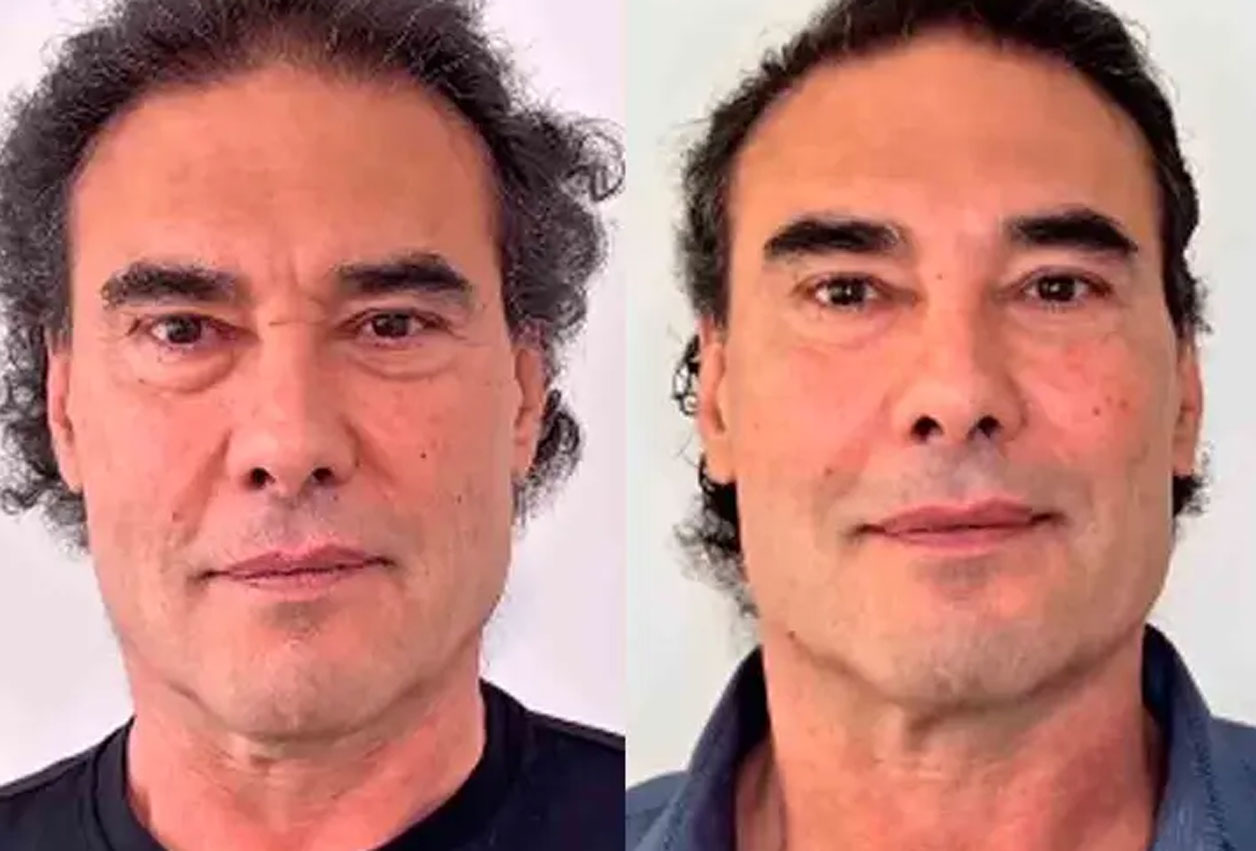 Yáñez se da una “manita de gato”