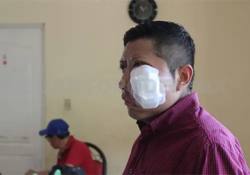 Albert necesita de todos para combatir el cáncer