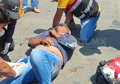 Queda malherido al ser atropellado