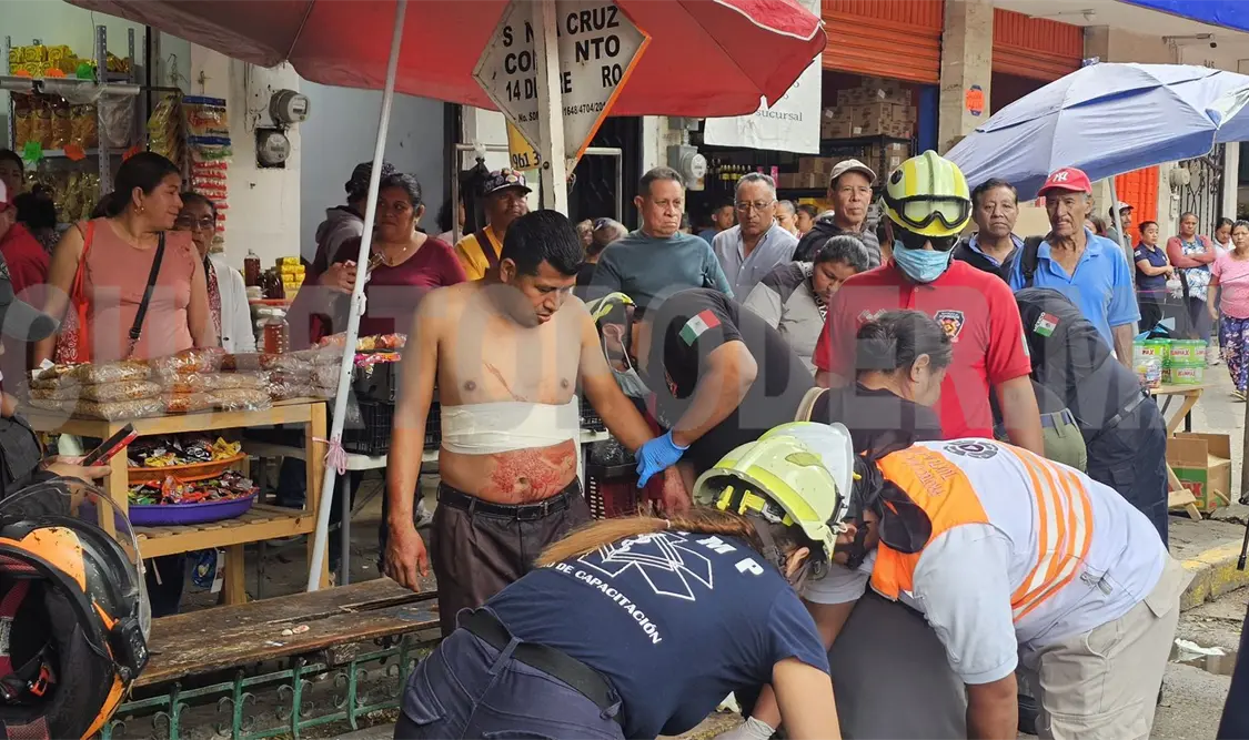 Lo acuchillan por vender audífonos defectuosos