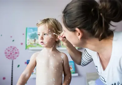 Piel sensible: cuando la crema no ayuda