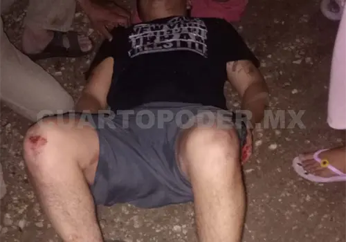Atropellan a un joven motorista y lo lesionan