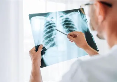 Así puedes prevenir la pulmonía