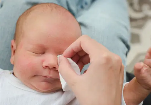 Conjuntivitis: cómo reconocerla y cuidarla Conjuntivitis: cómo reconocerla y cuidarla