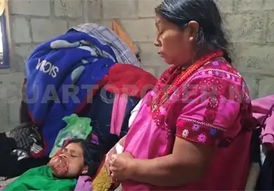 Mujer indígena con cáncer pide apoyo Mujer indígena con cáncer pide apoyo