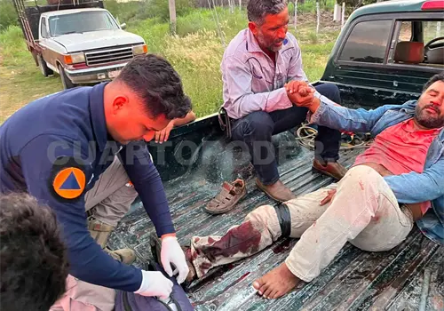 Se fractura un tobillo al accidentarse en moto